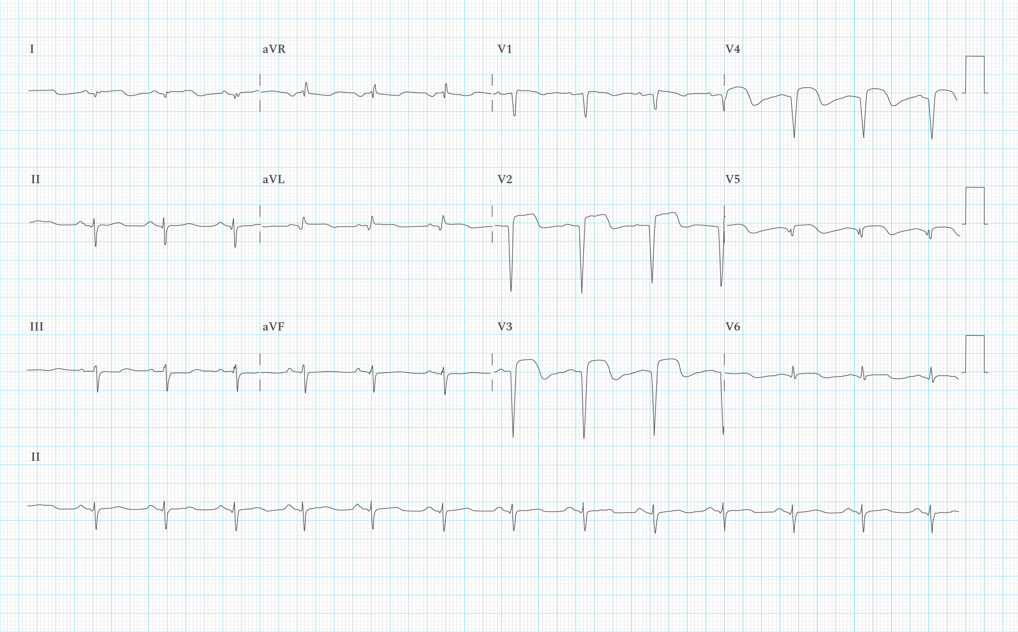 12-lead-ecg-practice-quiz-v1-skillstat